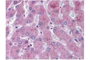 anti-NOTCH 2 antibody was diluted 1:500 to detect NOTCH 2 in human liver tissue. (NOTCH2 抗体  (N-Term))