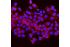 IF analysis of Aldolase/ALDOB using anti-Aldolase/ALDOB antibody (ABIN7602563). (ALDOB 抗体  (AA 85-364))
