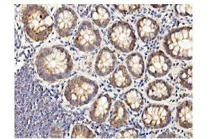 IHC analysis of BubR1/BUB1B using anti-BubR1/BUB1B antibody (ABIN7600961).