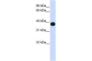 DEGS1 antibody used at 1 ug/ml to detect target protein. (DEGS1 抗体)
