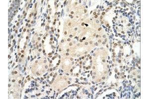 PUF60 antibody was used for immunohistochemistry at a concentration of 4-8 ug/ml. (PUF60 抗体  (C-Term))