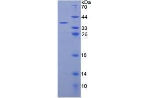 SDS-PAGE analysis of Human C3a Protein. (C3a 蛋白)