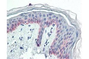 Immunohistochemical analysis of paraffin-embedded human skin tissues using CK5 mouse mAb. (Cytokeratin 5 抗体)