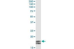 Immunoprecipitation of MYL2 transfected lysate using anti-MYL2 monoclonal antibody and Protein A Magnetic Bead , and immunoblotted with MYL2 MaxPab rabbit polyclonal antibody.