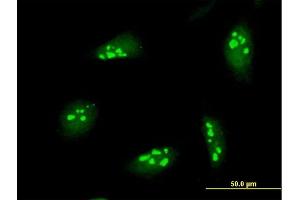 Immunofluorescence of purified MaxPab antibody to NOL7 on HeLa cell. (NOL7 抗体  (AA 1-257))