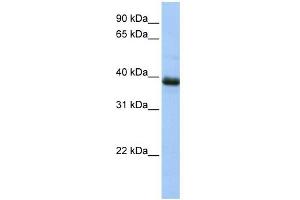 SPO11 antibody used at 1 ug/ml to detect target protein. (SPO11 抗体)