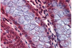 Human Colon: Formalin-Fixed, Paraffin-Embedded (FFPE) (Calcyphosine 2 抗体  (Internal Region))