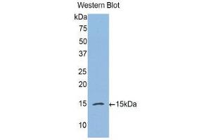 Western Blotting (WB) image for anti-Complement Factor B (CFB) (AA 270-388) antibody (ABIN1175357) (Complement Factor B 抗体  (AA 270-388))