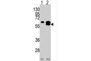 Western blot analysis of CAMK1G (arrow) using rabbit polyclonal CAMK1G polyclonal antibody . (CAMK1G 抗体  (C-Term))