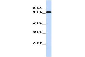 SLC6A1 antibody used at 1 ug/ml to detect target protein. (SLC6A1 抗体)