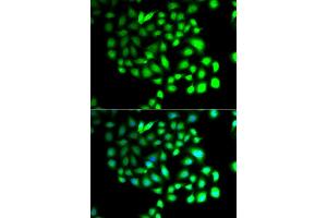 Immunofluorescence analysis of A549 cell using TCEAL8 antibody. (TCEAL8 抗体)