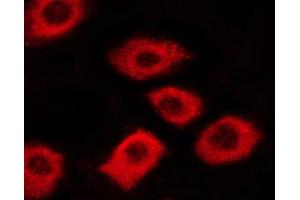 ABIN6267340 staining A431 cells by ICC/IF. (c-MET 抗体  (pTyr1003))
