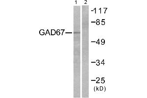 Western blot analysis of extracts from LOVO cells, using GAD67 antibody. (GAD 抗体)