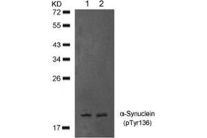 Image no. 1 for anti-Synuclein, alpha (SNCA) (pTyr136) antibody (ABIN401577) (SNCA 抗体  (pTyr136))
