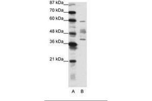 Image no. 1 for anti-Aprataxin (APTX) (N-Term) antibody (ABIN202287) (Aprataxin 抗体  (N-Term))