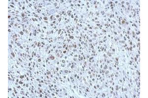 Immunohistochemistry (IHC) image for anti-POM121 Membrane Glycoprotein (POM121) (N-Term) antibody (ABIN2855297)