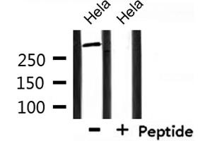 Western blot analysis of extracts from Hela , using Factor VIII Antibody.