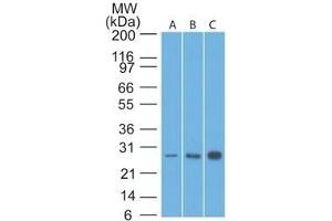 Western Blot Analysis of Bcl-2 in human A) HeLa, B) A549 and C) MCF7 lysate using Bcl-2 Mouse Monoclonal Antibody (8C8). (Bcl-2 抗体  (AA 41-54))