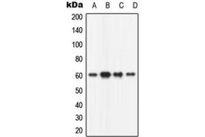 Western blot analysis of CaMK2 beta expression in HeLa (A), mouse brain (B), rat brain (C), PC12 (D) whole cell lysates. (CAMK2B 抗体  (N-Term))