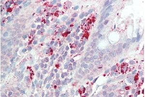 ABIN2613443 (5µg/ml) staining of paraffin embedded Human Colon. (IL3RA 抗体  (Internal Region))