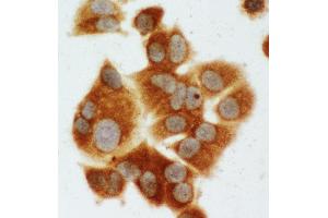 Anti-MEK1 antibody, ICC ICC: MCF-7 Cell (MEK1 抗体  (C-Term))