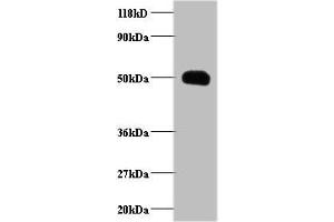 Western blot All lanes: CCL2 antibody at 2 μg/mL + EC109 whole cell lysate Secondary Goat polyclonal to rabbit IgG at 1/15000 dilution Predicted band size: 12 kDa Observed band size: 50 kDa (CCL2 抗体  (AA 24-99))