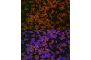 Immunofluorescence analysis of THP-1 cells using CD38 Rabbit pAb (ABIN6130076, ABIN6138177, ABIN6138178 and ABIN6217677) at dilution of 1:100 (40x lens). (CD38 抗体  (AA 46-300))
