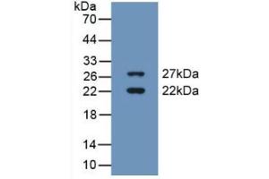 Western blot analysis of recombinant Human CIRBP. (CIRBP 抗体  (AA 1-172))