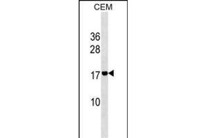ADM2 Antibody (N-term) (ABIN1539062 and ABIN2849503) western blot analysis in CEM cell line lysates (35 μg/lane). (Adrenomedullin 2 抗体  (AA 15-42))