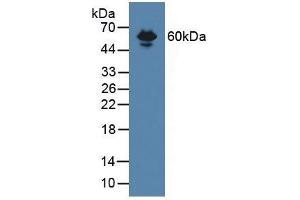 Detection of ENG in Mouse Serum using Polyclonal Antibody to Endoglin (ENG) (Endoglin 抗体  (AA 27-137))
