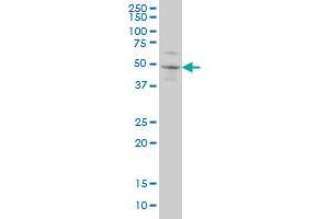 SOX3 monoclonal antibody (M04), clone 1F2 Western Blot analysis of SOX3 expression in A-431 .
