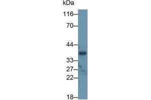 Detection of OGN in Rat Lung lysate using Polyclonal Antibody to Osteoglycin (OGN) (OGN 抗体  (AA 180-298))