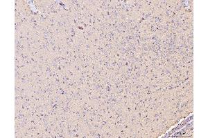 IHC analysis of MT-CO2 using anti-MT-CO2 antibody (ABIN7599081). (COX2 抗体  (AA 1-205))