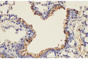 Immunohistochemistry of paraffin-embedded Mouse lung using PLAUR Ployclonal Antibody at dilution of 1:200. (PLAUR 抗体)