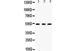 Western Blotting (WB) image for anti-5-Hydroxytryptamine (serotonin) Receptor 2A (HTR2A) (AA 400-431), (C-Term) antibody (ABIN3042729) (HTR2A 抗体  (C-Term))