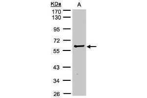 WB Image Sample(30 μg of whole cell lysate) A:Raji, 10% SDS PAGE antibody diluted at 1:2000 (RIPK2 抗体)
