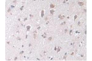 IHC-P analysis of Human Brain Tissue, with DAB staining. (STIP1 抗体  (AA 1-169))