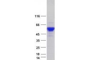 Western Blotting (WB) image for serpin Peptidase Inhibitor, Clade A (Alpha-1 Antiproteinase, Antitrypsin), Member 1 (SERPINA1) (Transcript Variant 6) protein (Myc-DYKDDDDK Tag) (ABIN2714596)