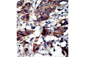 Image no. 2 for anti-Protein Kinase C and Casein Kinase Substrate in Neurons 3 (PACSIN3) (N-Term) antibody (ABIN360557)