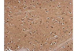 IHC-P Image RSK2 antibody detects RSK2 protein at cytosol and nucleus on rat middle brain by immunohistochemical analysis. (RPS6KA3 抗体  (Center))