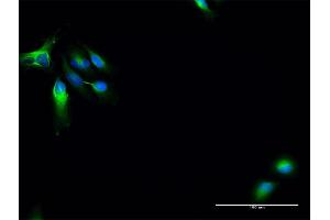 Immunofluorescence of purified MaxPab antibody to MAP7 on HeLa cell. (MAP7 抗体  (AA 1-749))