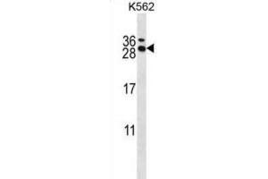 Western Blotting (WB) image for anti-RCAN Family Member 3 (RCAN3) antibody (ABIN2997962) (RCAN3 抗体)