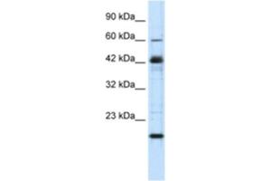 Western Blotting (WB) image for anti-Zinc Finger Protein 24 (ZNF24) antibody (ABIN2460740) (ZNF24 抗体)