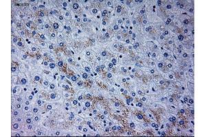 Immunohistochemical staining of paraffin-embedded liver tissue using anti-NEUROG3mouse monoclonal antibody. (Neurogenin 3 抗体)