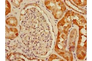 Immunohistochemistry of paraffin-embedded human kidney tissue using ABIN7175150 at dilution of 1:100 (USHBP1 抗体  (AA 1-260))