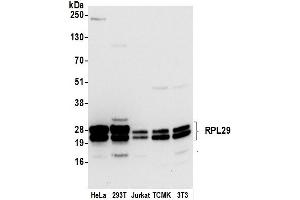 anti-Ribosomal Protein L29 (RPL29) (AA 109-159) antibody