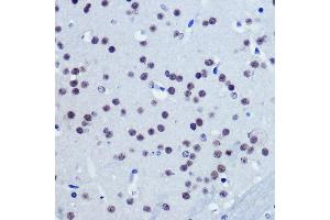 Immunohistochemistry of paraffin-embedded Mouse brain using Vgll4 Rabbit pAb (ABIN7271320) at dilution of 1:100 (40x lens). (VGLL4 抗体)