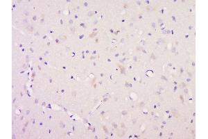Paraformaldehyde-fixed, paraffin embedded rat brain, Antigen retrieval by boiling in sodium citrate buffer (pH6) for 15min, Block endogenous peroxidase by 3% hydrogen peroxide for 30 minutes, Blocking buffer (normal goat serum) at 37°C for 20min, Antibody incubation with Rabbit Anti-Neurotrophin 3 Polyclonal Antibody, Unconjugated  ) at 1:200 overnight at 4°C, followed by a conjugated secondary for 90 minutes and DAB staining (Neurotrophin 3 抗体  (AA 19-100))