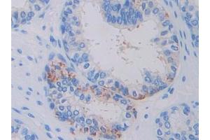 Used in DAB staining on fromalin fixed paraffin- embedded glioma tissue (Factor VII 抗体  (AA 334-452))