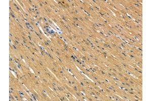 ABIN7094629 and ABIN7098679 at 1/100 staining Rat heart tissue by IHC-P. (TOM1L2 抗体  (Internal Region))
